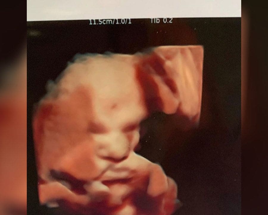 A Scan of the 22nd Radford Baby